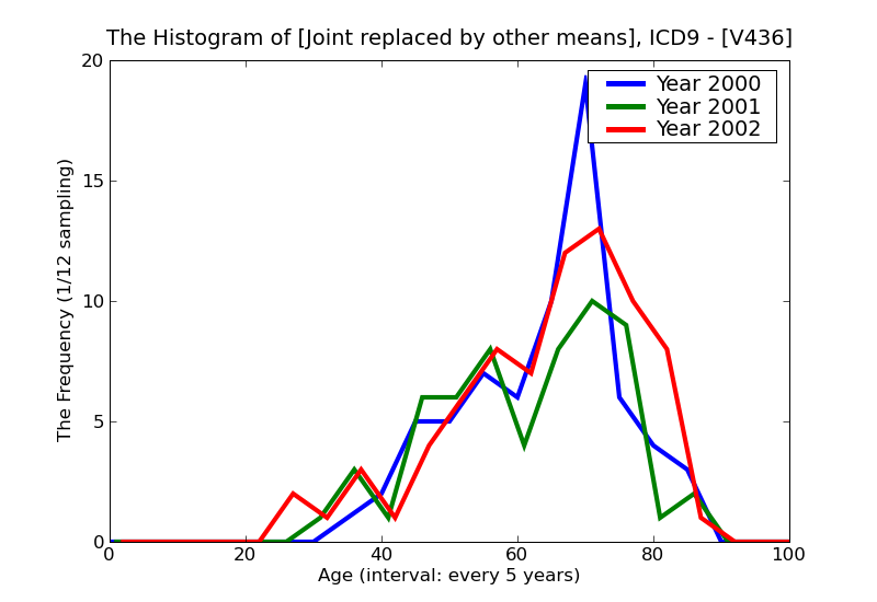 ICD9 Histogram Joint replaced by other means