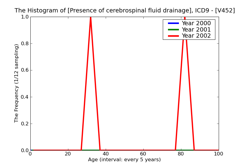 ICD9 Histogram Presence of cerebrospinal fluid drainage device