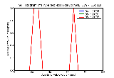 ICD9 Histogram Hypersecretion glaucoma