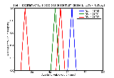 ICD9 Histogram Dislocations of sternum closed